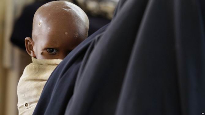 Somali Kuraklığın Pençesinde 5