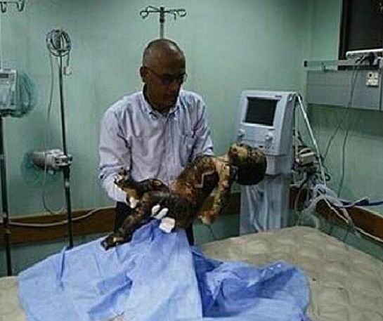 İsrail Gazze'yi Vurdu; Kassam Komutanı da Şehitler Arasında! 8