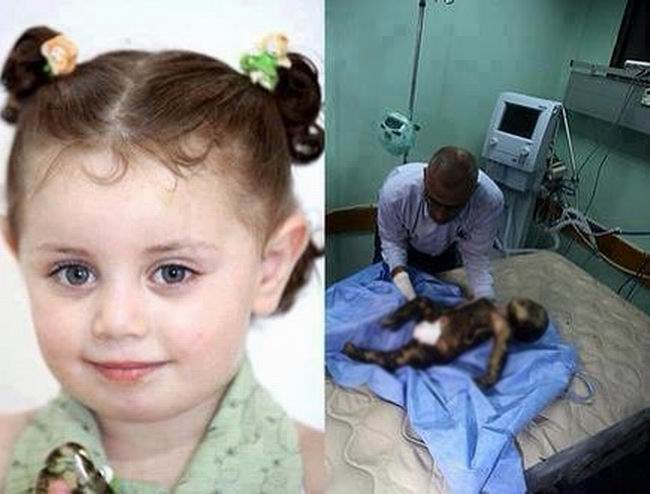 Gazze'de Katledilen Bebek ve Çocuklar 21