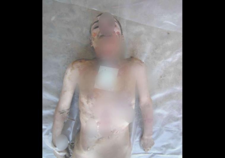 Esed Rejiminin İşkencelerinin Yeni Fotoğrafları 2