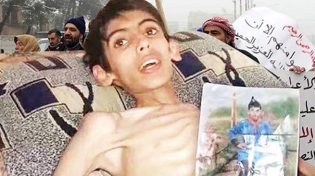 Madaya’dan Kaçış Yok; Açlık Var, Ölüm Var! 1