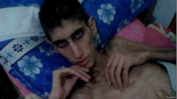 Madaya’dan Kaçış Yok; Açlık Var, Ölüm Var! 6