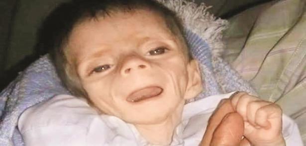 Madaya’dan Kaçış Yok; Açlık Var, Ölüm Var! 7