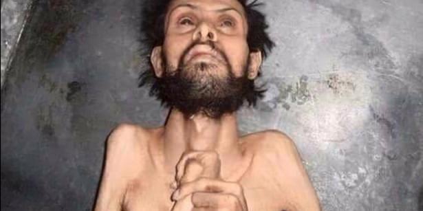 Madaya’dan Kaçış Yok; Açlık Var, Ölüm Var! 8