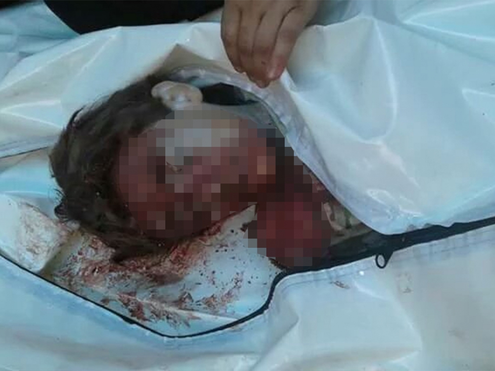 Rusya Halep'i Vurdu, Yine Çocuklar Öldü 1