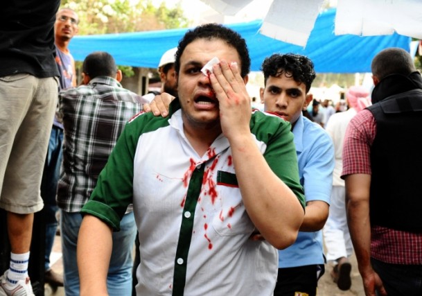 Mısır Adeviyye Meydanında Katliam 17