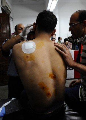 Mısır Adeviyye Meydanında Katliam 8