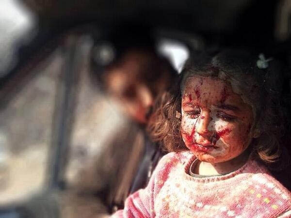 Halep'te Varil Katliamı Devam Ediyor! 4
