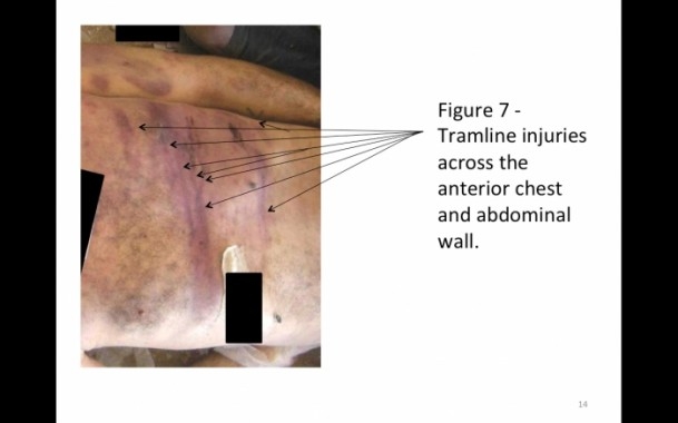 Suriye'de savaş suçu belgeleri 11