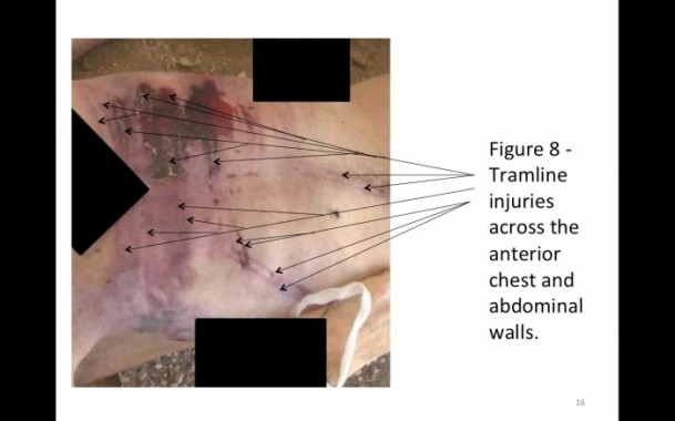 Suriye'de savaş suçu belgeleri 13