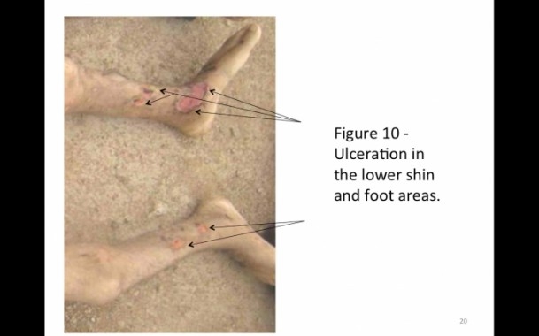 Suriye'de savaş suçu belgeleri 14