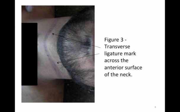 Suriye'de savaş suçu belgeleri 3