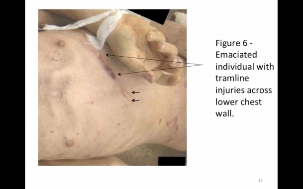 Suriye'de savaş suçu belgeleri 9