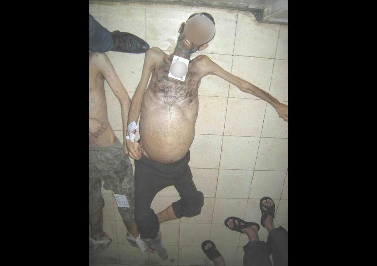 Esed Rejiminin İşkencelerinin Yeni Fotoğrafları 6