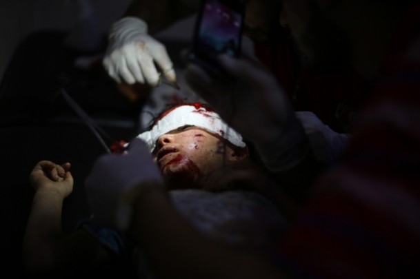 Duma'ya Vakum Bombalı Saldırı 11