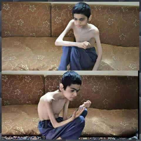 Madaya’dan Kaçış Yok; Açlık Var, Ölüm Var! 5