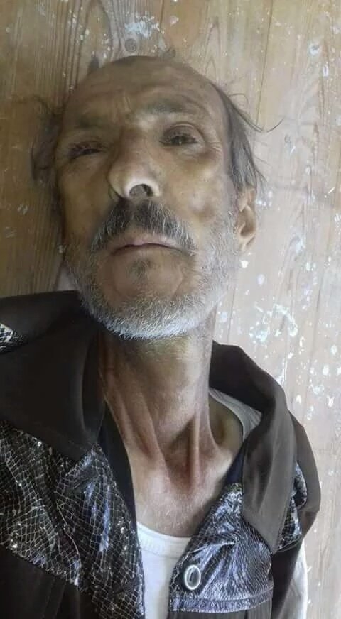 Madaya’dan Kaçış Yok; Açlık Var, Ölüm Var! 9