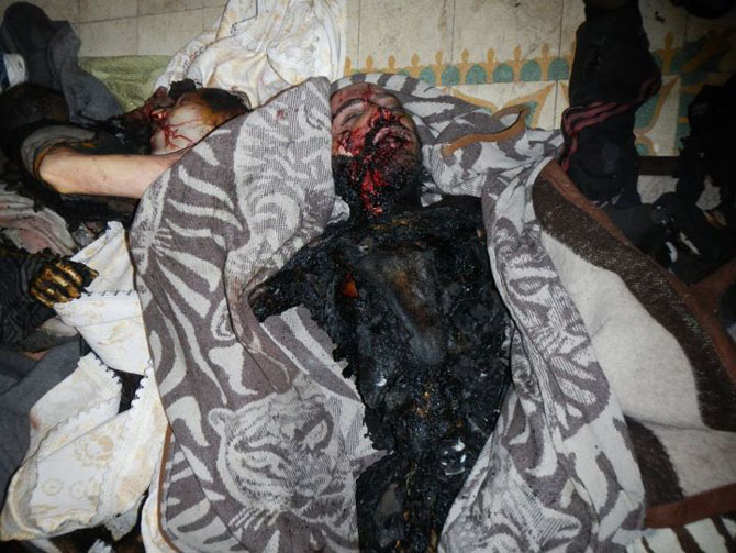 (+18) Humus-Kerem Zeytunda Yaşanan Katliamın Görüntüleri 22