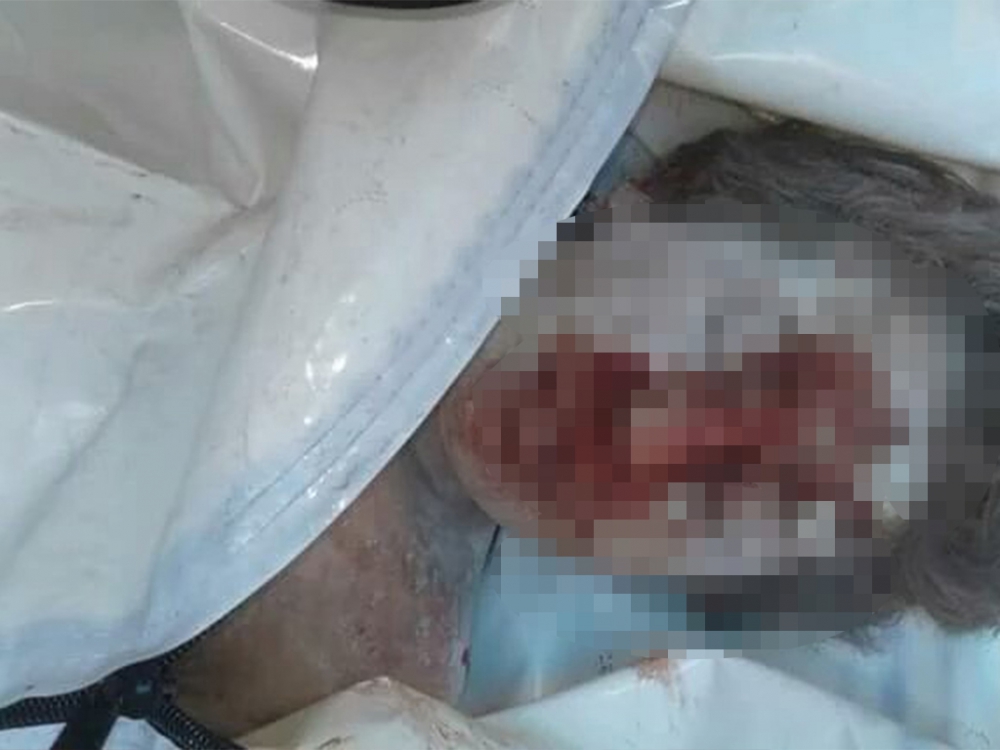 Rusya Halep'i Vurdu, Yine Çocuklar Öldü 3