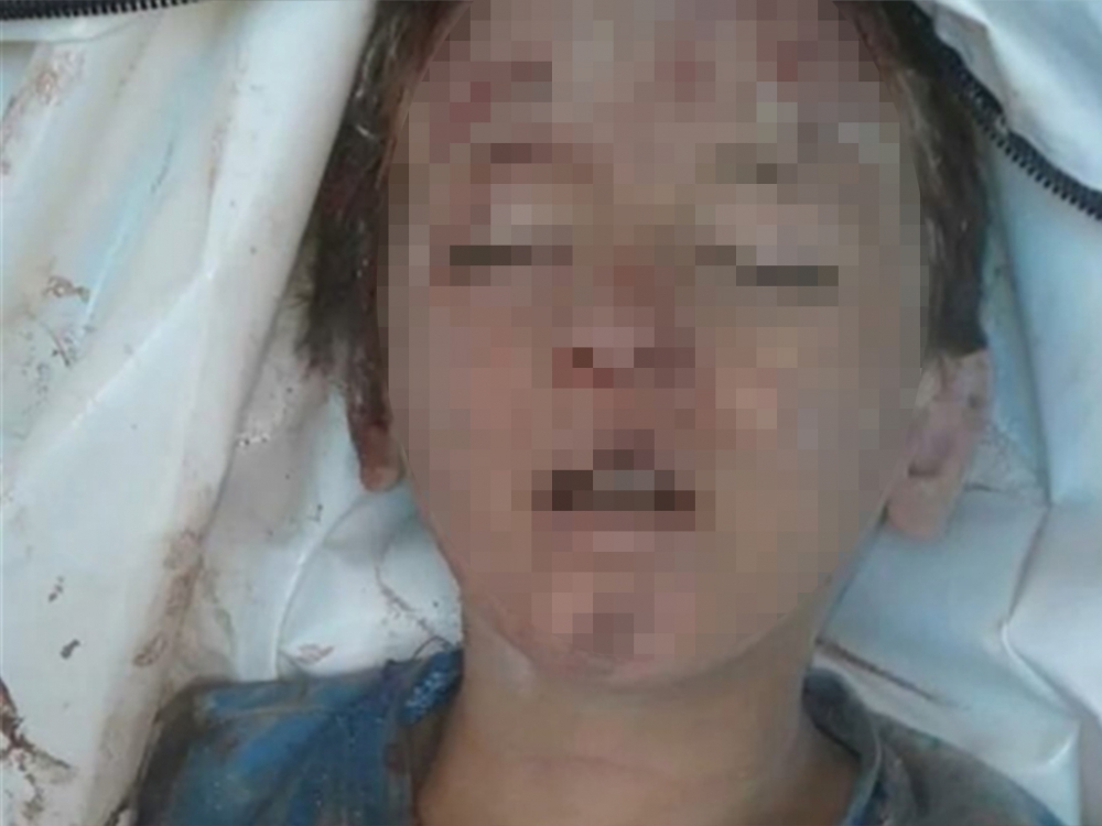 Rusya Halep'i Vurdu, Yine Çocuklar Öldü 4
