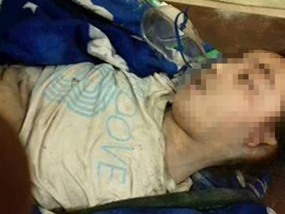 Rusya Halep'i Vurdu, Yine Çocuklar Öldü 6