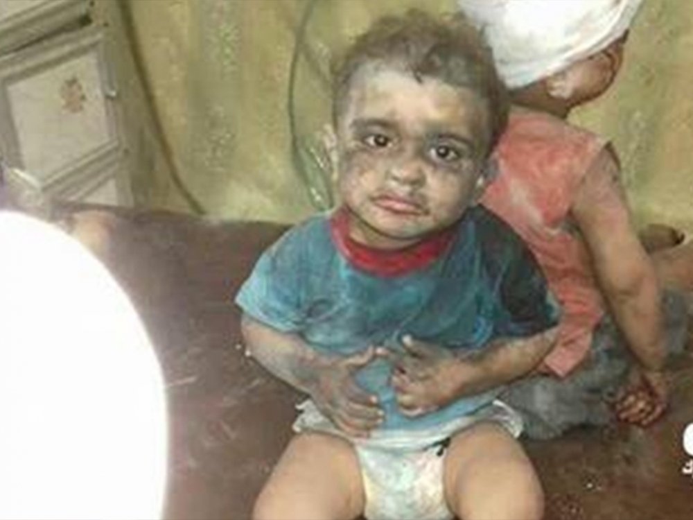 Rusya Halep'i Vurdu, Yine Çocuklar Öldü 7