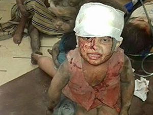 Rusya Halep'i Vurdu, Yine Çocuklar Öldü