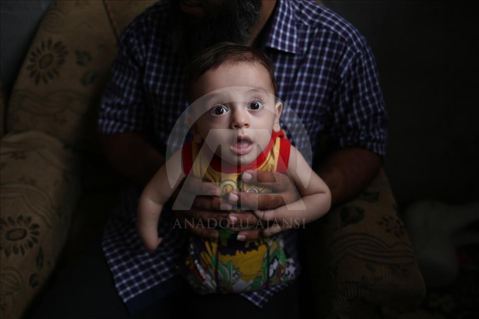 Gazze'de Engelli 3 Kardeşin Protez Hayali 3
