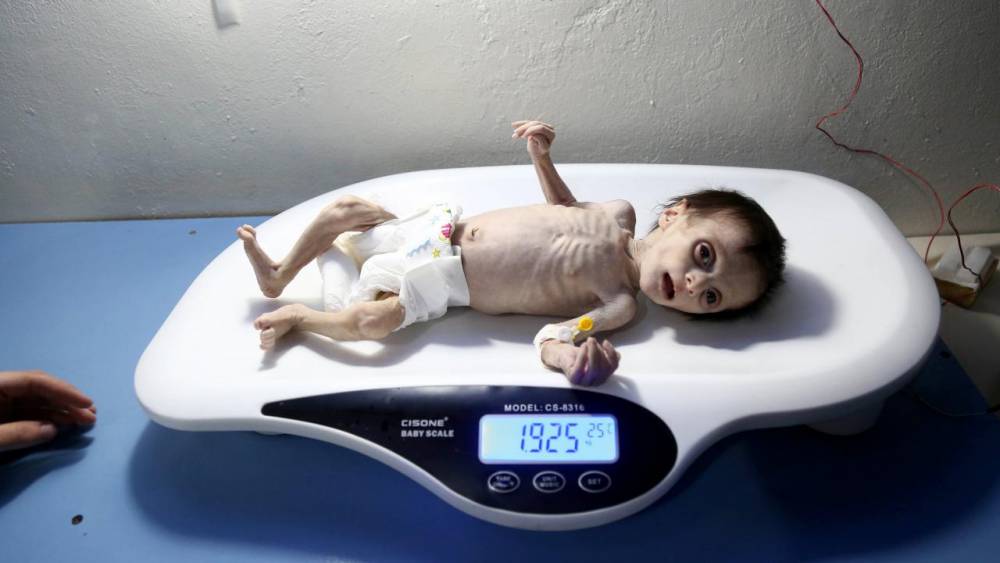 11 yıldır Suriye’de dünyanın kör kaldığı kareler 11