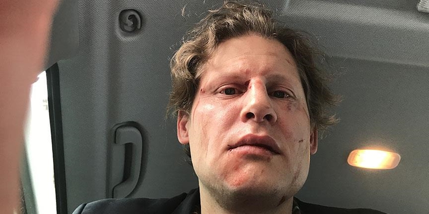 PKK Yandaşları Almanyalı Gazeteciyi Darp Etti!