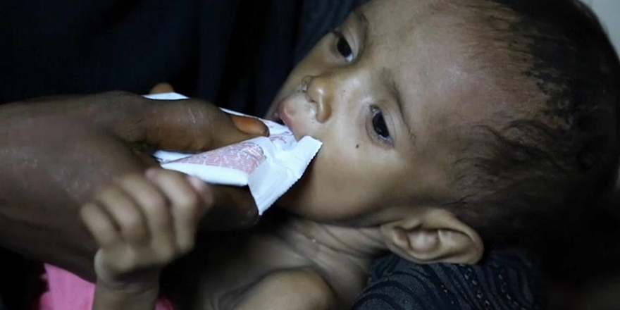 Yemen’deki Kolera Salgını: Can Kaybı Sayısı 2 Bin 101 Oldu!