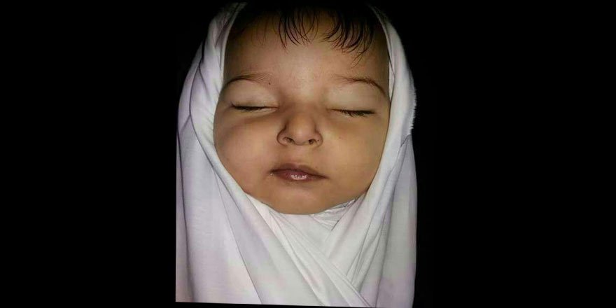 Esed-İran-Rusya Cephesinin Zalim Ablukası Ümâme Bebeği Öldürdü!