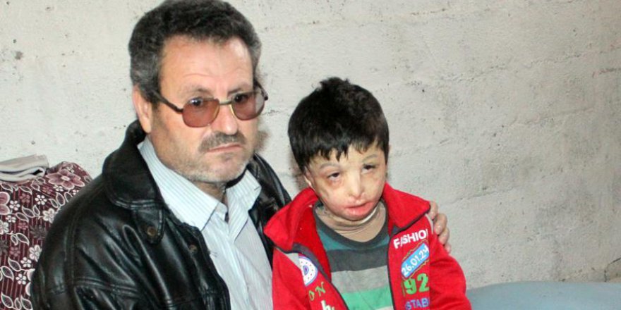 Suriyeli Mahmud'u Varil Bombası Yaktı