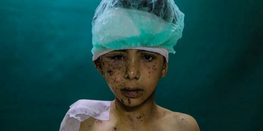 Doğu Guta'da 'Vahşet Politikası' Kazandı