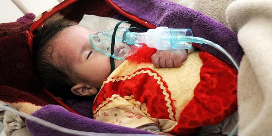Yemen'deki Kolera Salgınında Ölü Sayısı 2 Bin 300'ü Aştı