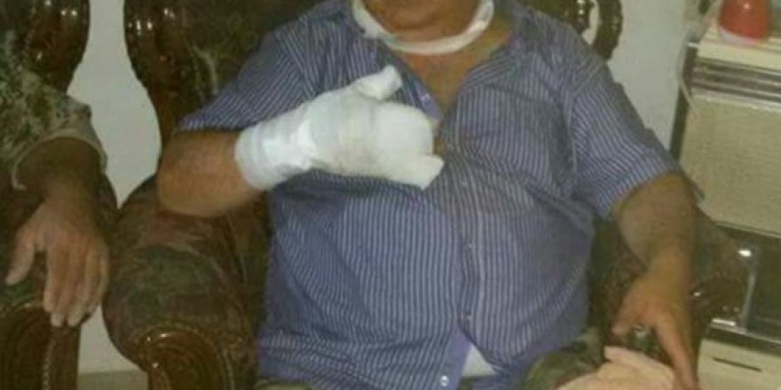 Mihraç Ural, Ebu Amara Tugayı’nın Saldırısında Yaralandı