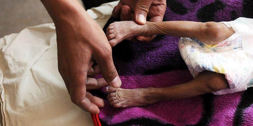 ICRC: Milyonlarca Yemenli Aç Uyuyor
