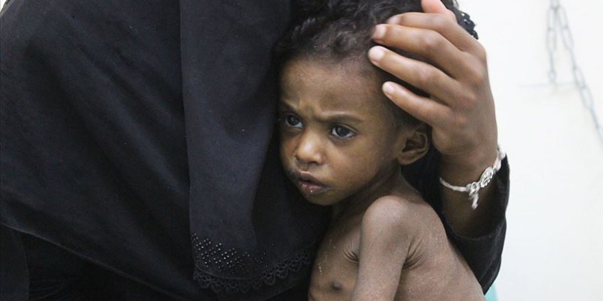 BM: 113 Milyondan Fazla İnsan Açlıkla Boğuşuyor