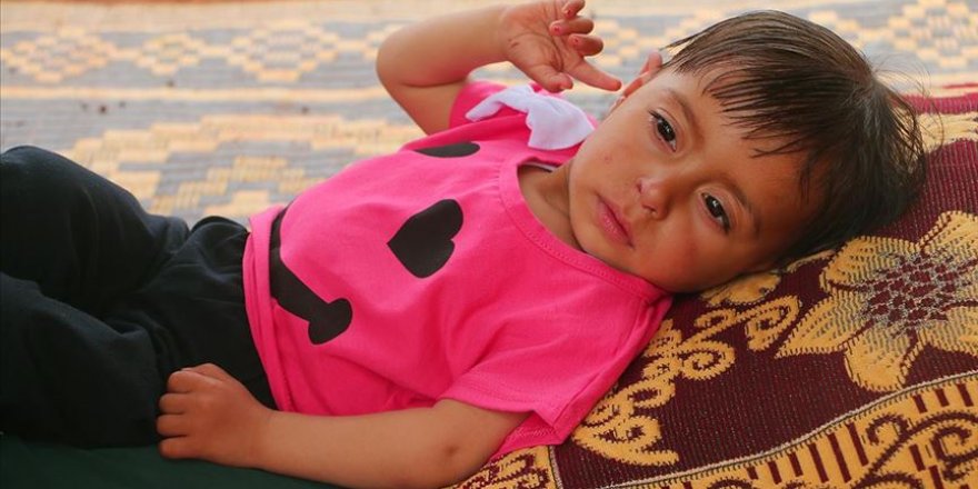 Suriyeli Minik Aye'nin Yaşaması Acil Ameliyata Bağlı