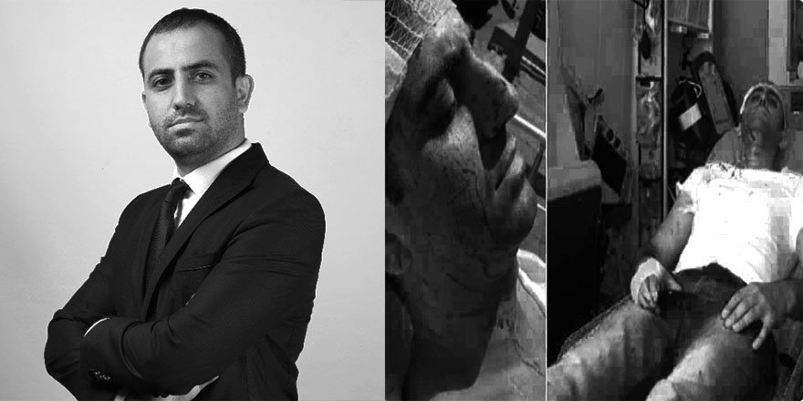 Murat Alan’a Saldıranların Siyasi Kimlikleri Tartışılıyor, MHP Suskun!