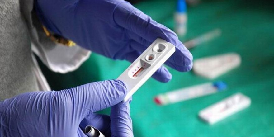 "Türkiye'de AIDS Vakaları Giderek Artıyor"