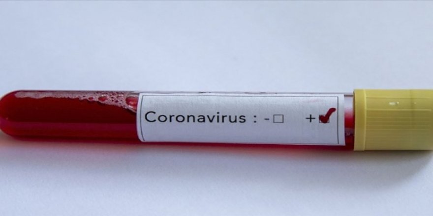 Koronavirüsten Ölenlerin Sayısı 2 Bin 717’ye Yükseldi