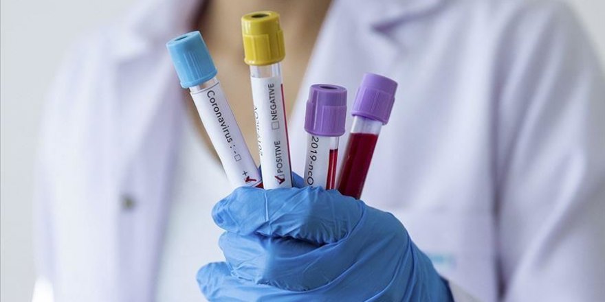 İran'da Bir Yetkili Daha Koronavirüse Yakalandı