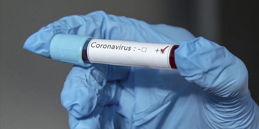 Ürdün'de İlk Koronavirüs Vakası Tespit Edildi