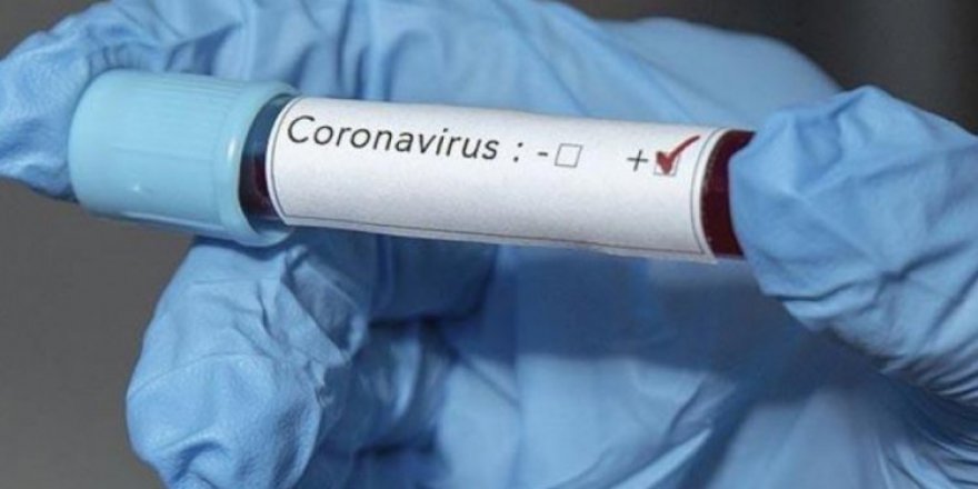 Çin’de Koronavirüs Salgınında Can Kaybı 3 Bin 14’e Çıktı