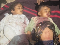 Yemenli Bebeklerin Katledilmesine Kim Dur Diyecek?