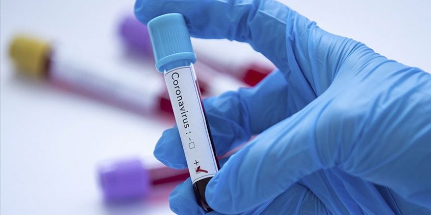 Bulgaristan’da 4 Kişide Yeni Tip Koronavirüs Tespit Edildi