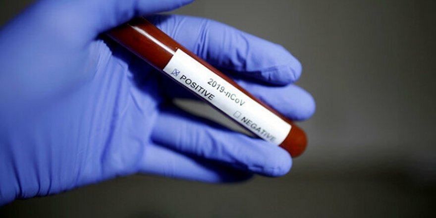 İsviçre'de Bir Günde 841 Yeni Tip Koronavirüs Vakası