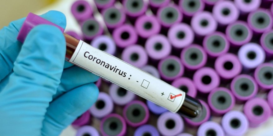 Testten Bahsetmeden Koronavirüs Tedbiri Konuşmak Faydasızdır