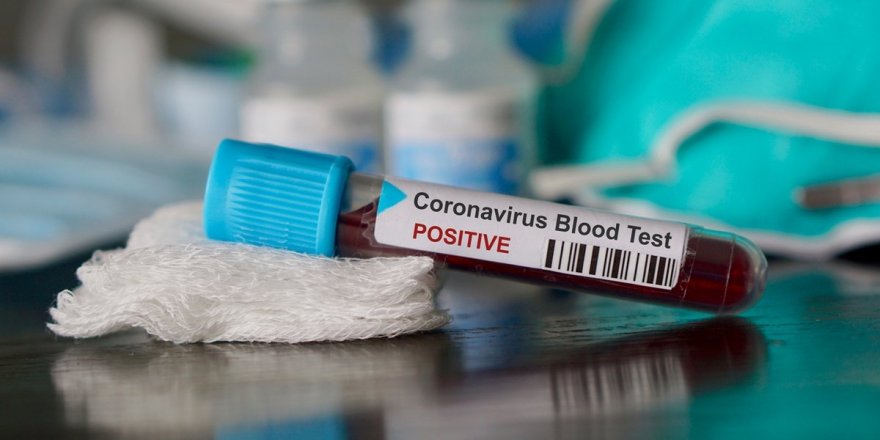 Türkiye’de Koronavirüs’te Hayatını Kaybedenlerin Sayısı 59’a Vaka Sayısı 2433’e Yükseldi
